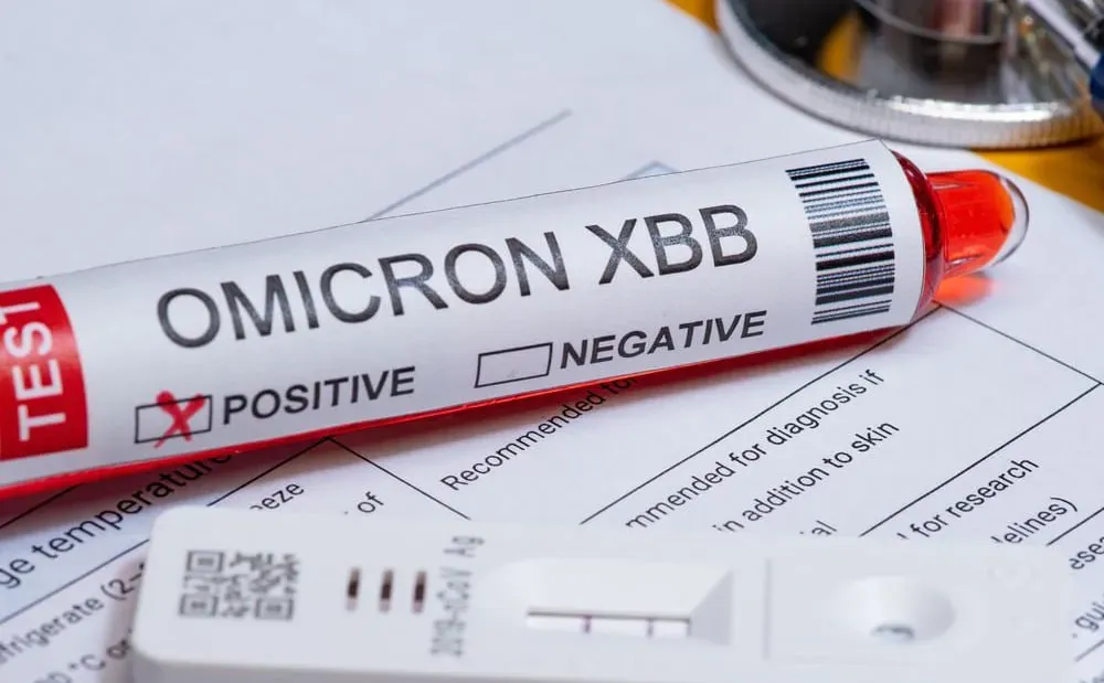 
											
											ЖССТ «омикрон»нинг янги субвариантини кузатув остига олди
											
											