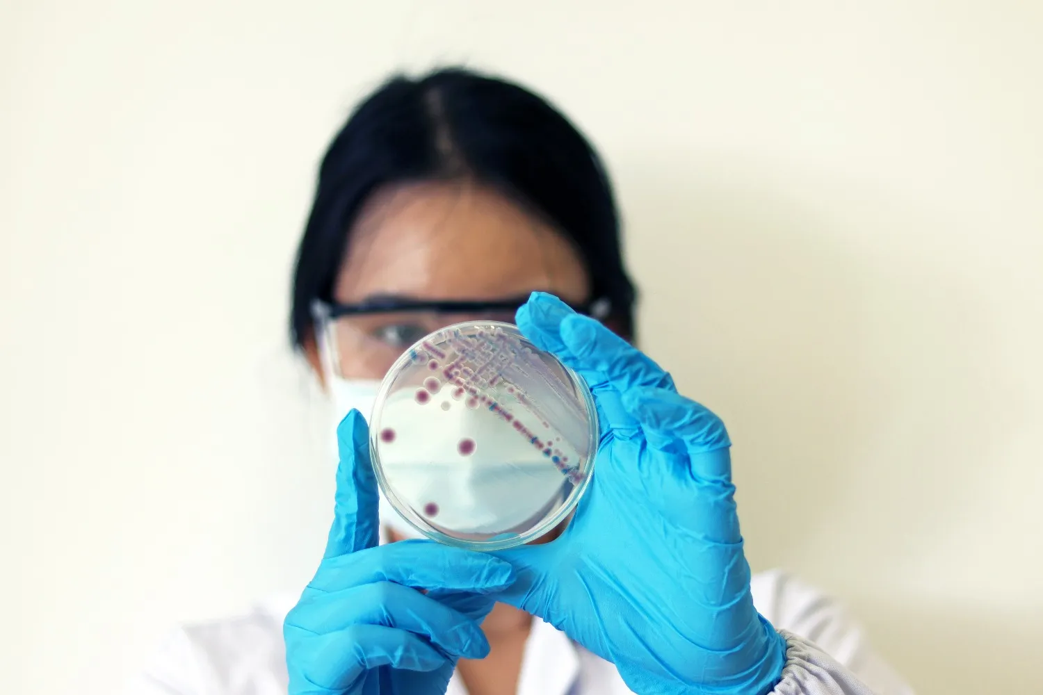 
											
											Флоридадаги довулдан сўнг 13 киши бактерия туфайли вафот этди
											
											