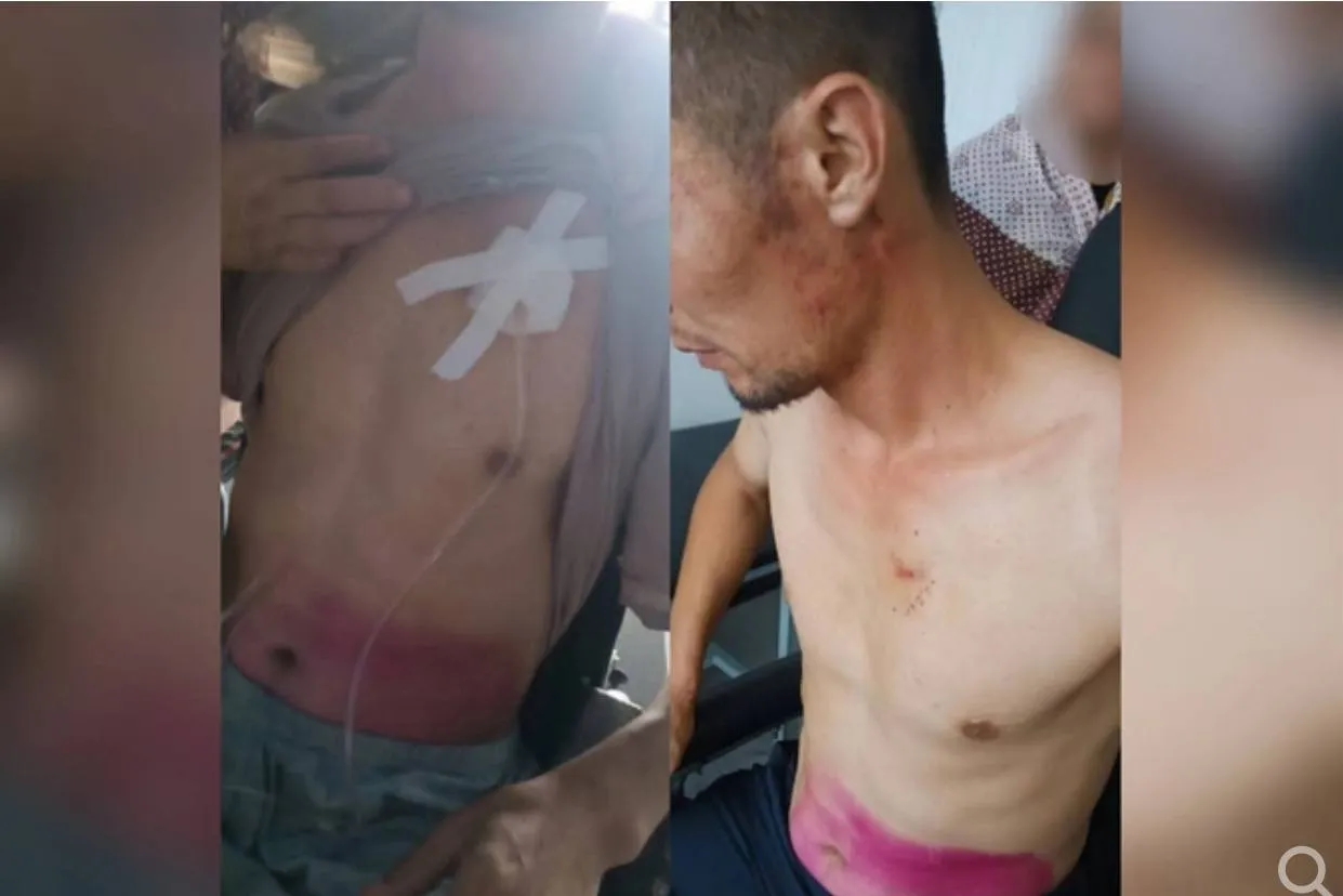 
											
											Наманган ИИББ: “Фуқарони қийноққа солганларга жиноят иши қўзғатилди”
											
											