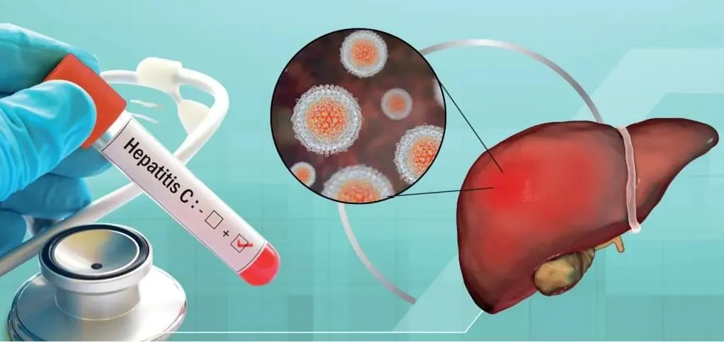
											
											Misr gepatit “S” ga qarshi dori vositasini O‘zbekistonda ishlab chiqarishni rejalashtirmoqda
											
											