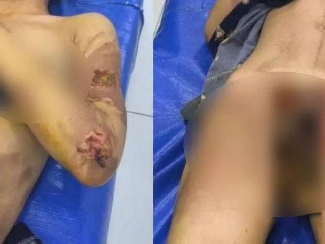 Jizzaxda kelin qaynoq suvdan kuygan: holat yuzasidan jinoyat ishi qo‘zg‘atildi